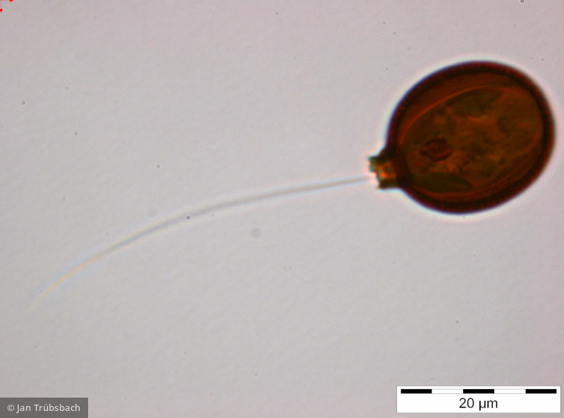 Trachelomonas_cf. similis_1255011070 - Euglenophyta Euglenophyceae Euglenales Trachelomonas similis