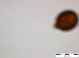 Trachelomonas_cf. similis_1255011142
