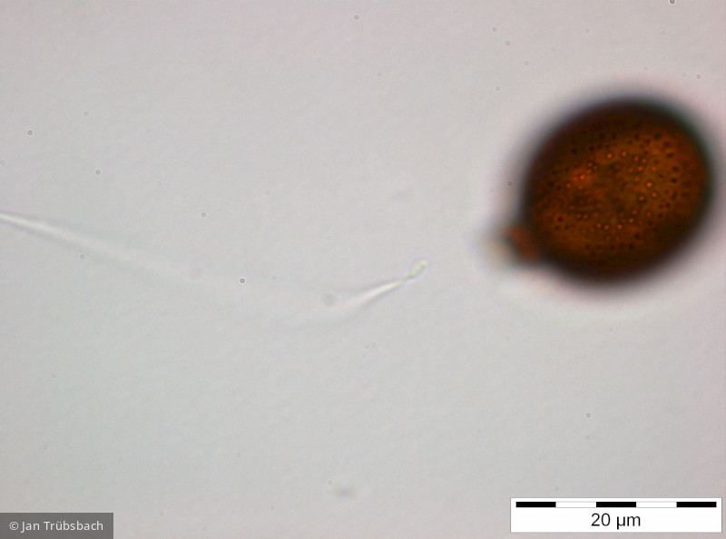 Trachelomonas_cf. similis_1255011142 - Euglenophyta Euglenophyceae Euglenales Trachelomonas similis