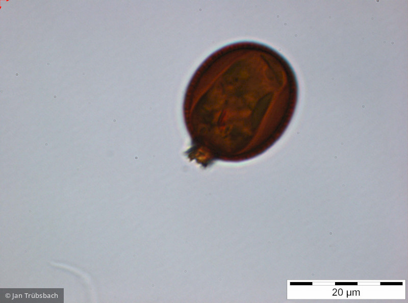 Trachelomonas_cf. similis_1255011220 - Euglenophyta Euglenophyceae Euglenales Trachelomonas similis