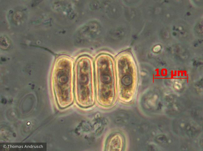 Chlorophyta Chlorophyceae Chlorococcales Desmodesmus communis