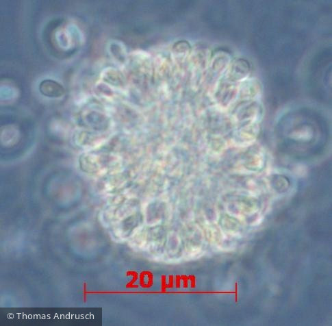 Cyanobacteria Cyanobacteria Chroococcales Woronichinia compacta