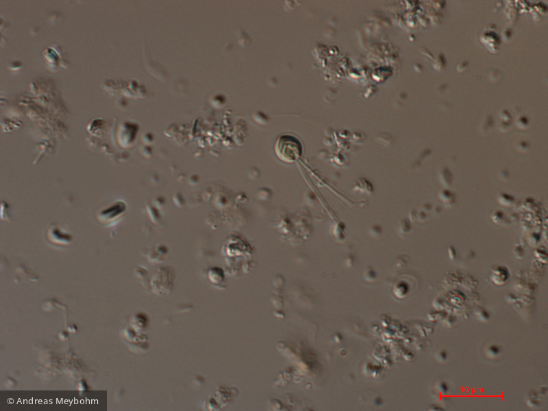 Scourfieldia_cordiformis_1276596614 - Chlorophyta Prasinophyceae Scourfieldiales Scourfieldia cordiformis