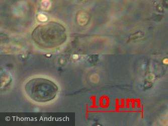 Chlorophyta Prasinophyceae Scourfieldiales Scourfieldia cordiformis