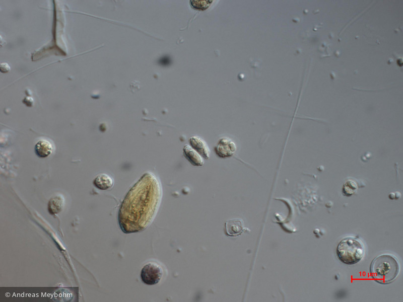 Scenedesmus_costato-granulatus_1271146864 - Chlorophyta Chlorophyceae Chlorococcales Desmodesmus costato-granulatus