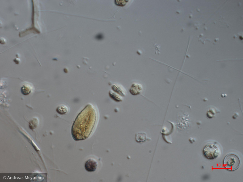 Scenedesmus_costato-granulatus_1271147057 - Chlorophyta Chlorophyceae Chlorococcales Desmodesmus costato-granulatus