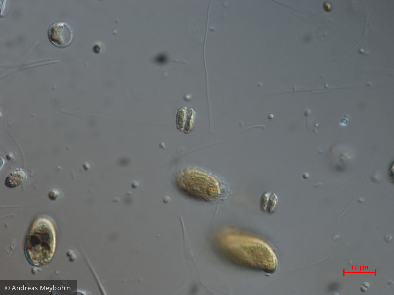 Scenedesmus_costato-granulatus_1271147289 - Chlorophyta Chlorophyceae Chlorococcales Desmodesmus costato-granulatus