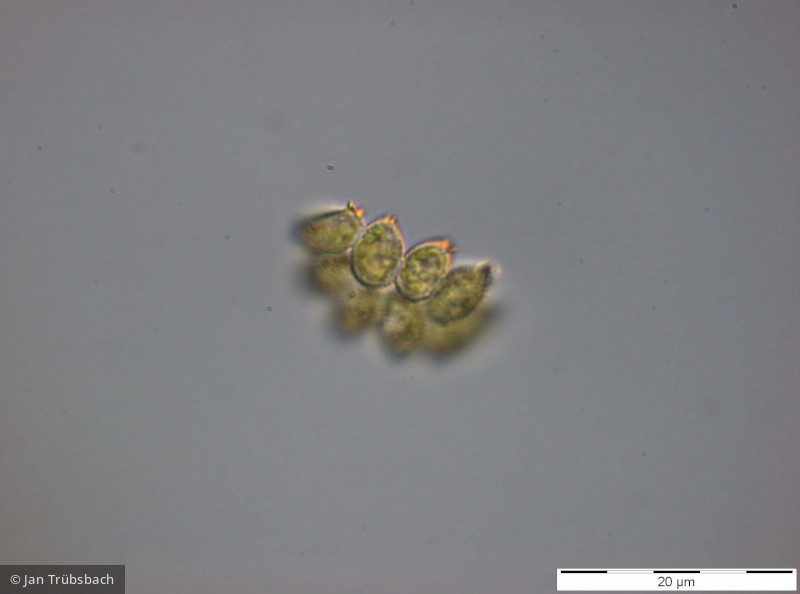 Chlorophyta Chlorophyceae Chlorococcales Desmodesmus denticulatus