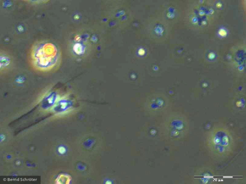 Protista Choanoflagellata Choanoflagellida Stelexomonas dichotoma