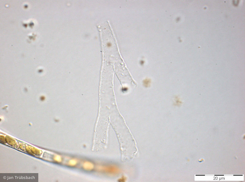 Protista Choanoflagellata Choanoflagellida Stelexomonas dichotoma