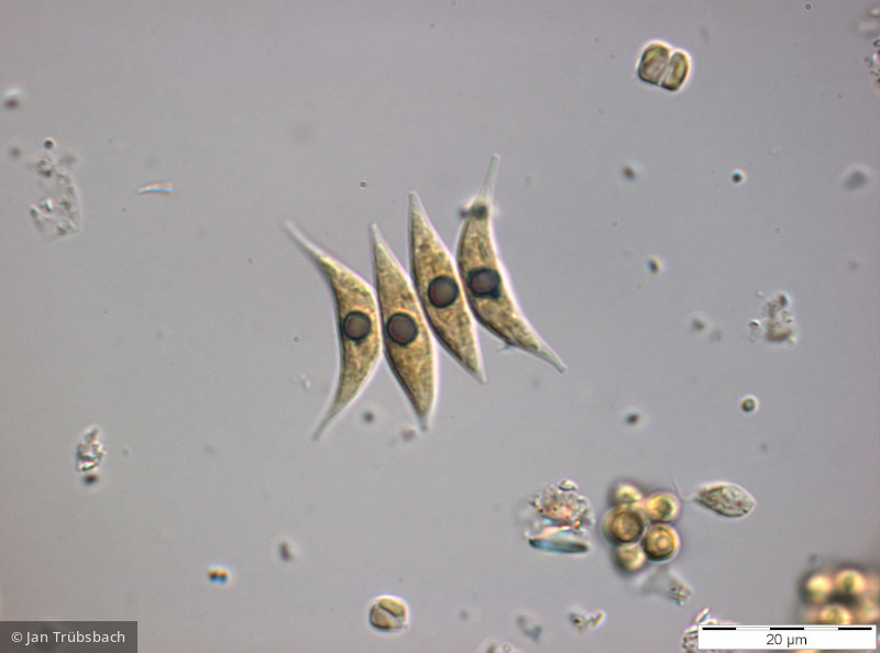 Chlorophyta Chlorophyceae Chlorococcales Tetradesmus dimorphus