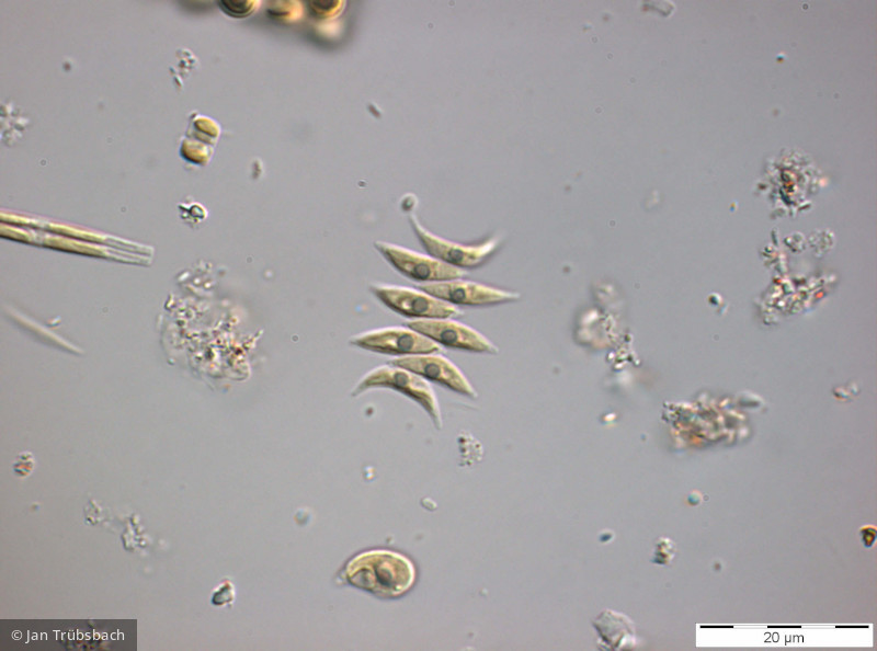 Chlorophyta Chlorophyceae Chlorococcales Tetradesmus dimorphus