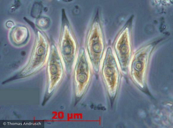 Chlorophyta Chlorophyceae Chlorococcales Tetradesmus dimorphus