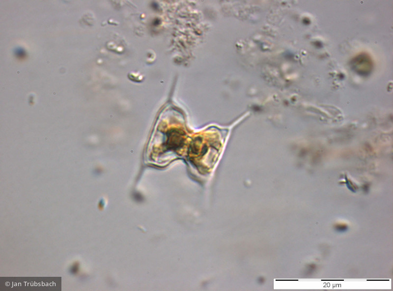 Chlorophyta Conjugatophyceae Desmidiales Staurodesmus extensus