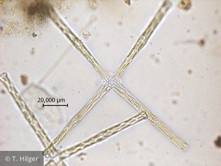 Tabellaria_fenestrata_1258443744 - Heterocontophyta Bacillariophyceae Pennales Tabellaria fenestrata