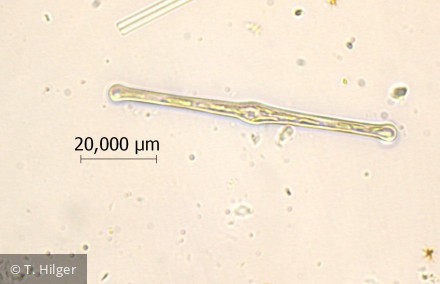 Tabellaria_fenestrata_1258443814 - Heterocontophyta Bacillariophyceae Pennales Tabellaria fenestrata