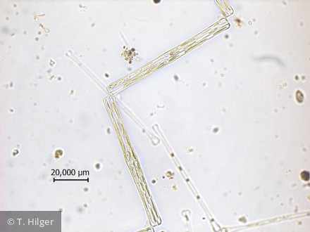 Tabellaria_fenestrata_1258444249 - Heterocontophyta Bacillariophyceae Pennales Tabellaria fenestrata