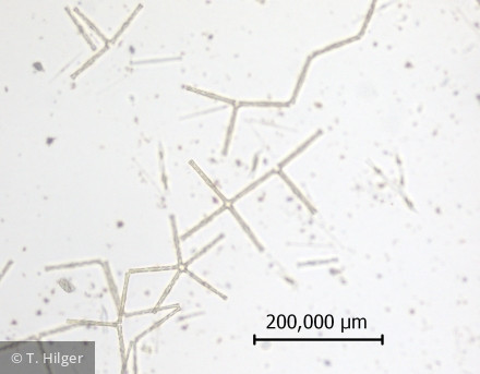 Tabellaria_fenestrata_1258444624 - Heterocontophyta Bacillariophyceae Pennales Tabellaria fenestrata
