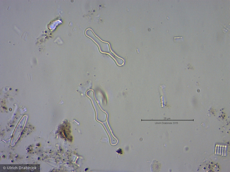 Heterocontophyta Bacillariophyceae Pennales Tabellaria fenestrata