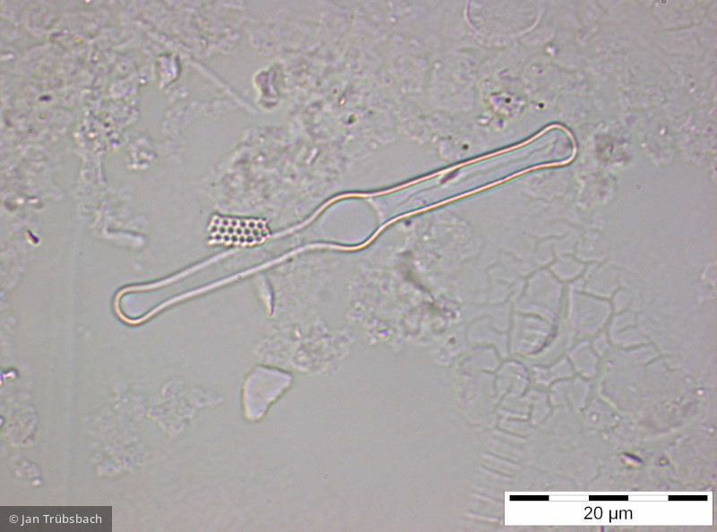Tabellaria_flocculosa_1259593626 - Heterocontophyta Bacillariophyceae Pennales Tabellaria flocculosa