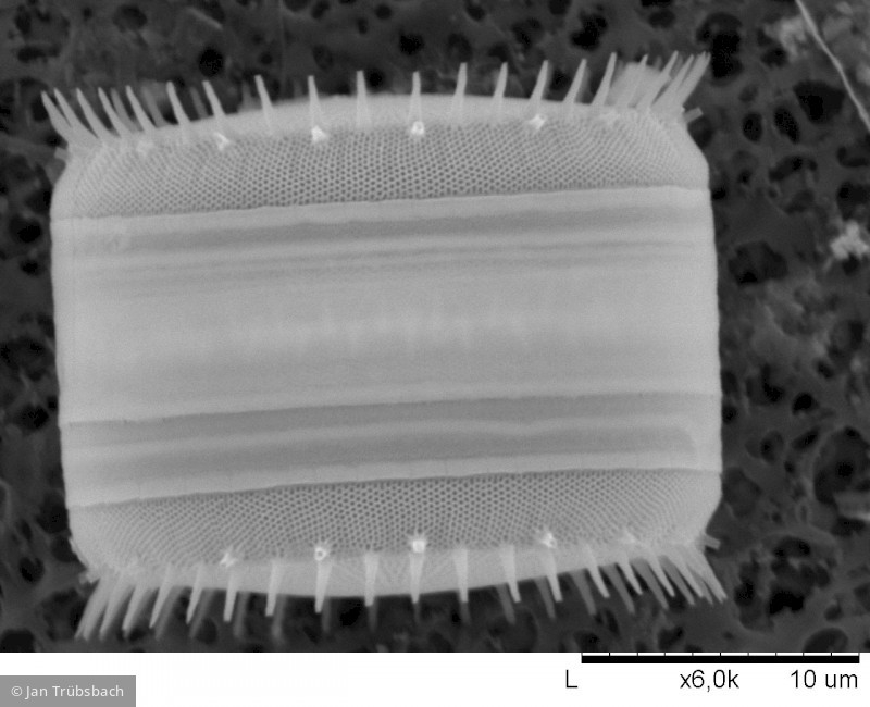 Stephanodiscus hantzschii · Heterocontophyta Bacillariophyceae Centrales · 10000x
