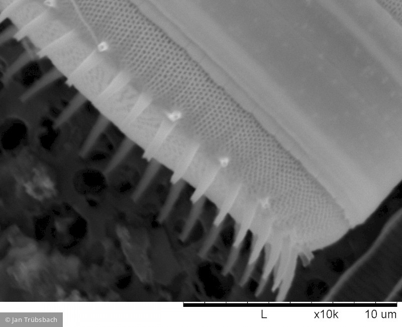 Stephanodiscus hantzschii · Heterocontophyta Bacillariophyceae Centrales · 10000x