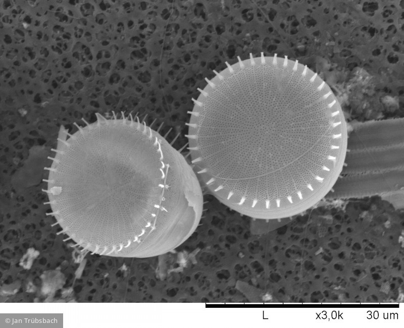 Stephanodiscus hantzschii · Heterocontophyta Bacillariophyceae Centrales · 10000x