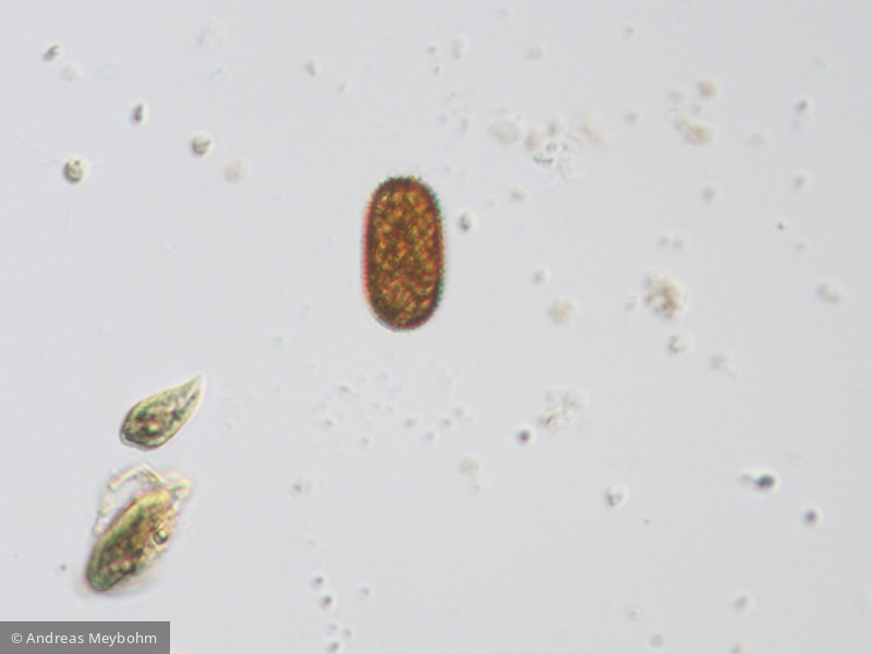 Trachelomonas_polonica_1253890375 - Euglenophyta Euglenophyceae Euglenales Trachelomonas hexangulata f. polonica