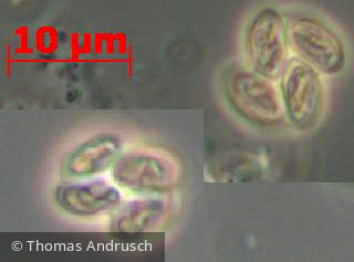 Chlorophyta Chlorophyceae Chlorococcales Tetrachlorella incerta