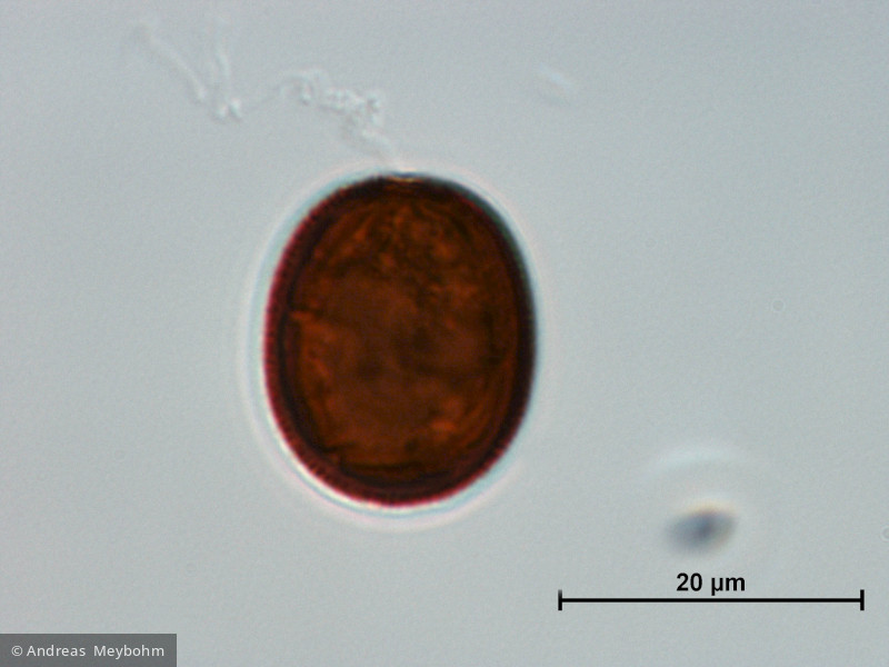 Trachelomonas_oblonga_1223481591 - Euglenophyta Euglenophyceae Euglenales Trachelomonas intermedia