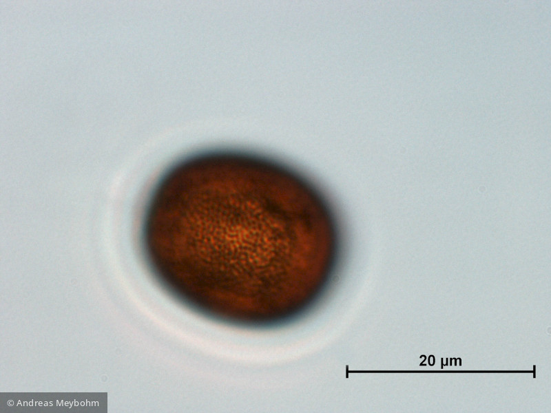 Trachelomonas_oblonga_1223481688 - Euglenophyta Euglenophyceae Euglenales Trachelomonas intermedia