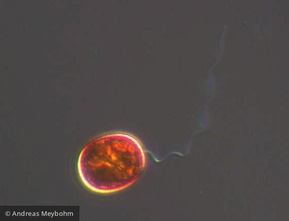 Trachelomonas_intermedia_1223482982 - Euglenophyta Euglenophyceae Euglenales Trachelomonas intermedia