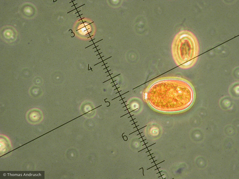 Euglenophyta Euglenophyceae Euglenales Trachelomonas intermedia