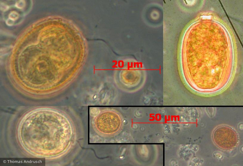 Euglenophyta Euglenophyceae Euglenales Trachelomonas intermedia