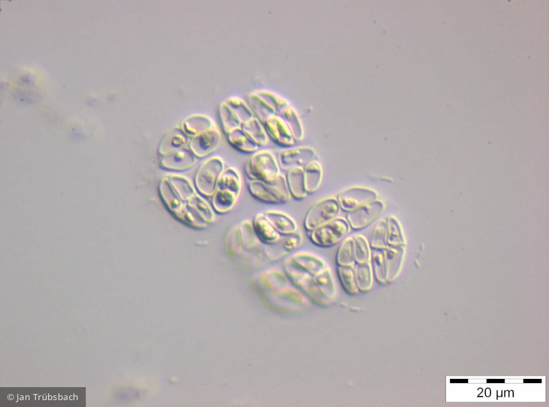 Willea_irregularis_1253802857 - Chlorophyta Chlorophyceae Chlorococcales Willea irregularis