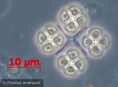 Chlorophyta Chlorophyceae Chlorococcales Lemmermannia komarekii