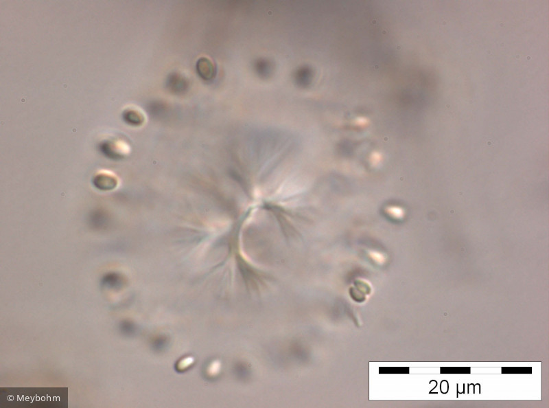 Snowella lacustris - Cyanobacteria Cyanobacteria Chroococcales Snowella lacustris