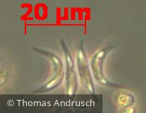 Chlorophyta Chlorophyceae Chlorococcales Tetradesmus lagerheimii