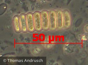Chlorophyta Chlorophyceae Chlorococcales Scenedesmus linearis