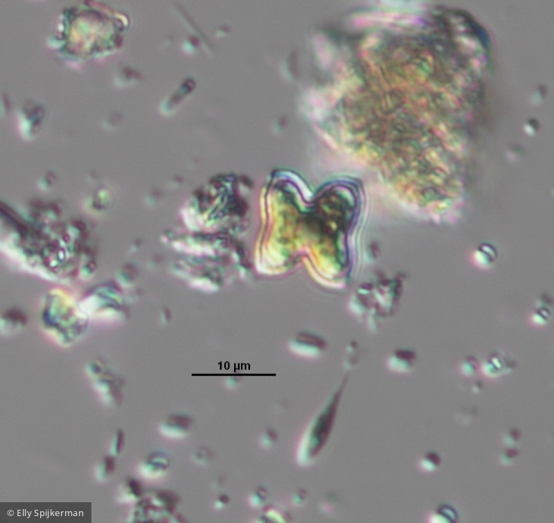 Chlorophyta Chlorophyceae Chlorococcales Tetraedron minimum