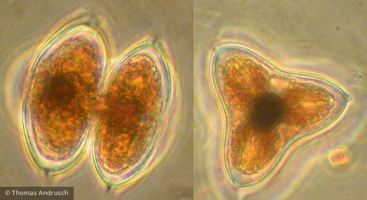 Staurastrum_mucronatum_1271449453 - Chlorophyta Conjugatophyceae Desmidiales Staurastrum mucronatum