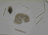 Woronichinia_naegeliana_1221907840