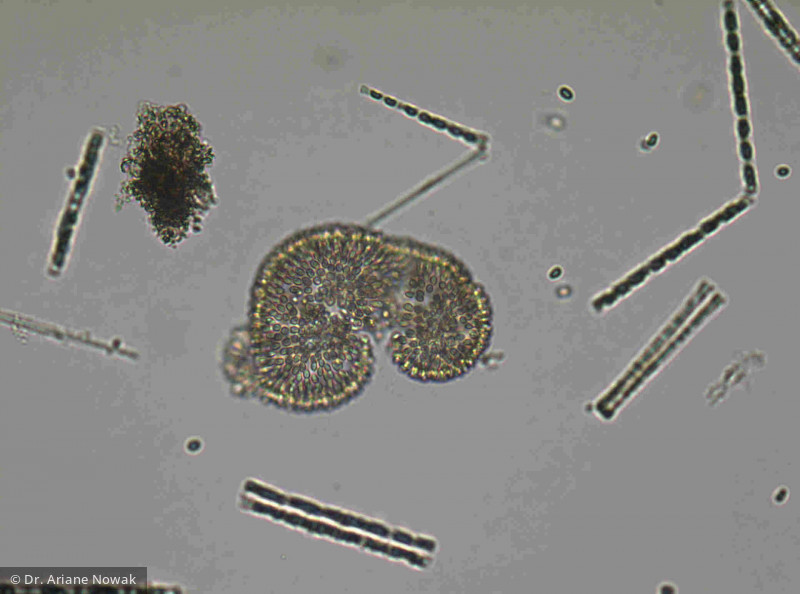 Woronichinia_naegeliana_1221907840 - Cyanobacteria Cyanobacteria Chroococcales Woronichinia naegeliana