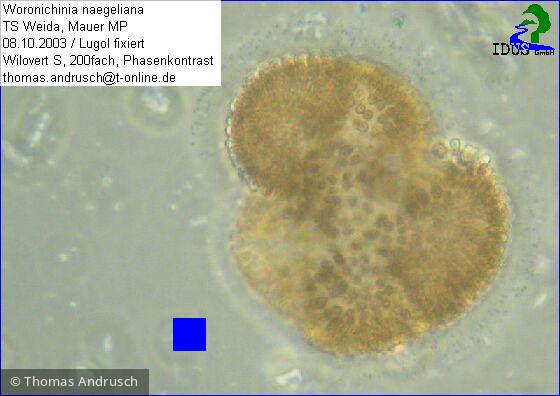 Woronichinia_naegeliana_1238686263 - Cyanobacteria Cyanobacteria Chroococcales Woronichinia naegeliana