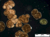 Woronichinia_naegeliana_1253708903