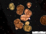Woronichinia_naegeliana_1253709247
