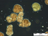 Woronichinia_naegeliana_1253709337