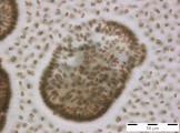 Woronichinia_naegeliana_1253709984