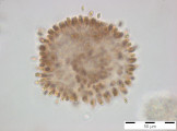Woronichinia_naegeliana_1254229111