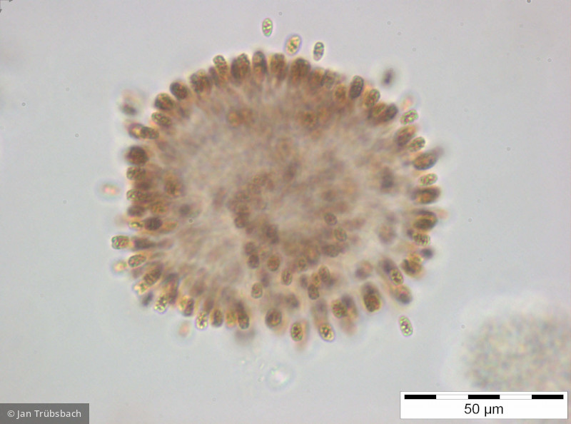 Woronichinia_naegeliana_1254229111 - Cyanobacteria Cyanobacteria Chroococcales Woronichinia naegeliana